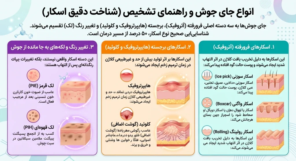 روش ترمیم جای جوش