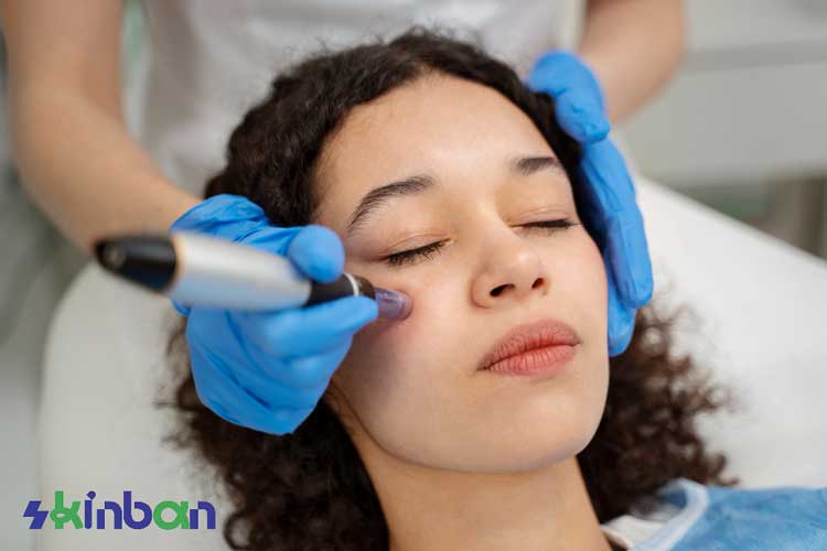 روش های میکرونیدلینگ