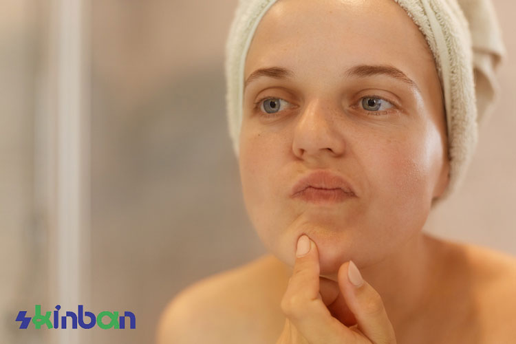 کاربرد میکرودرم ابریژن