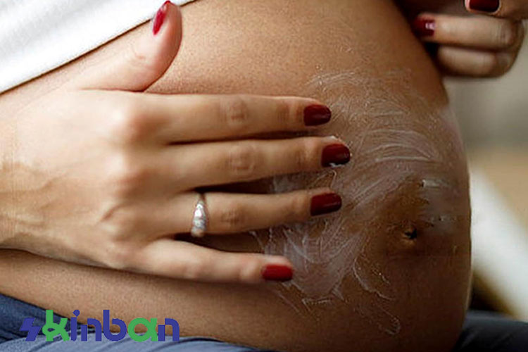 پیش گیری از ایجاد ترک پوستی