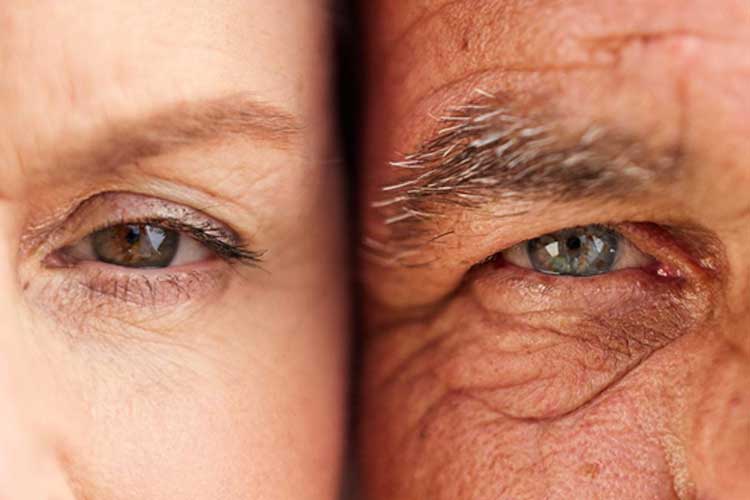 علت چین و چروک صورت