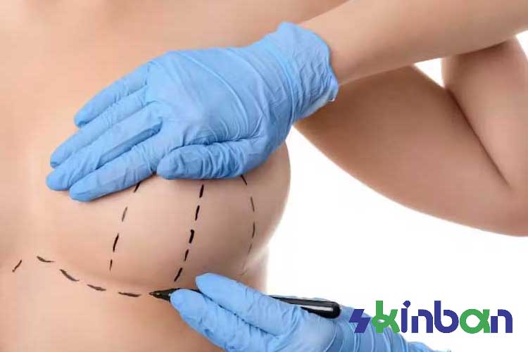 مراقبتهای بعد از جراحی لیفت سینه