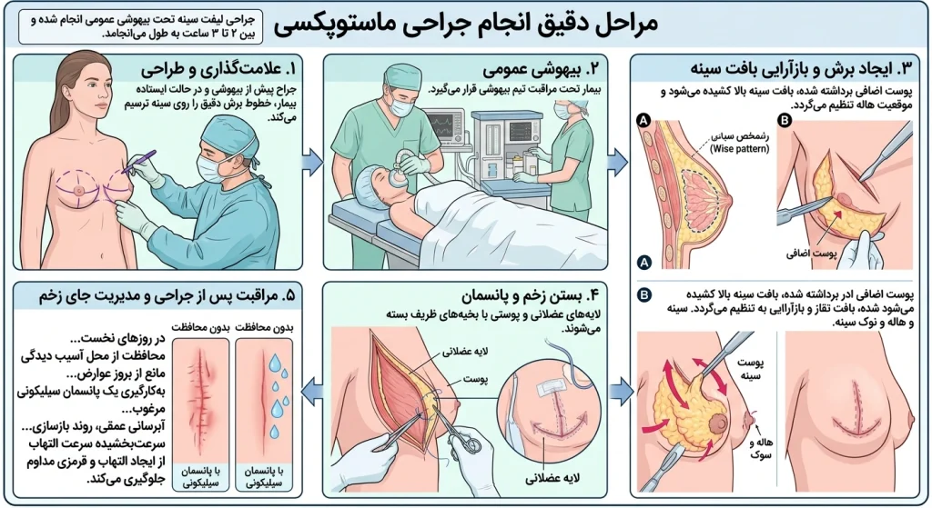مراحل دقیق انجام جراحی ماستوپکسی