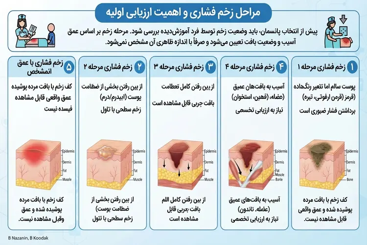مراحل زخم بستر و اهمیت ارزیابی اولیه